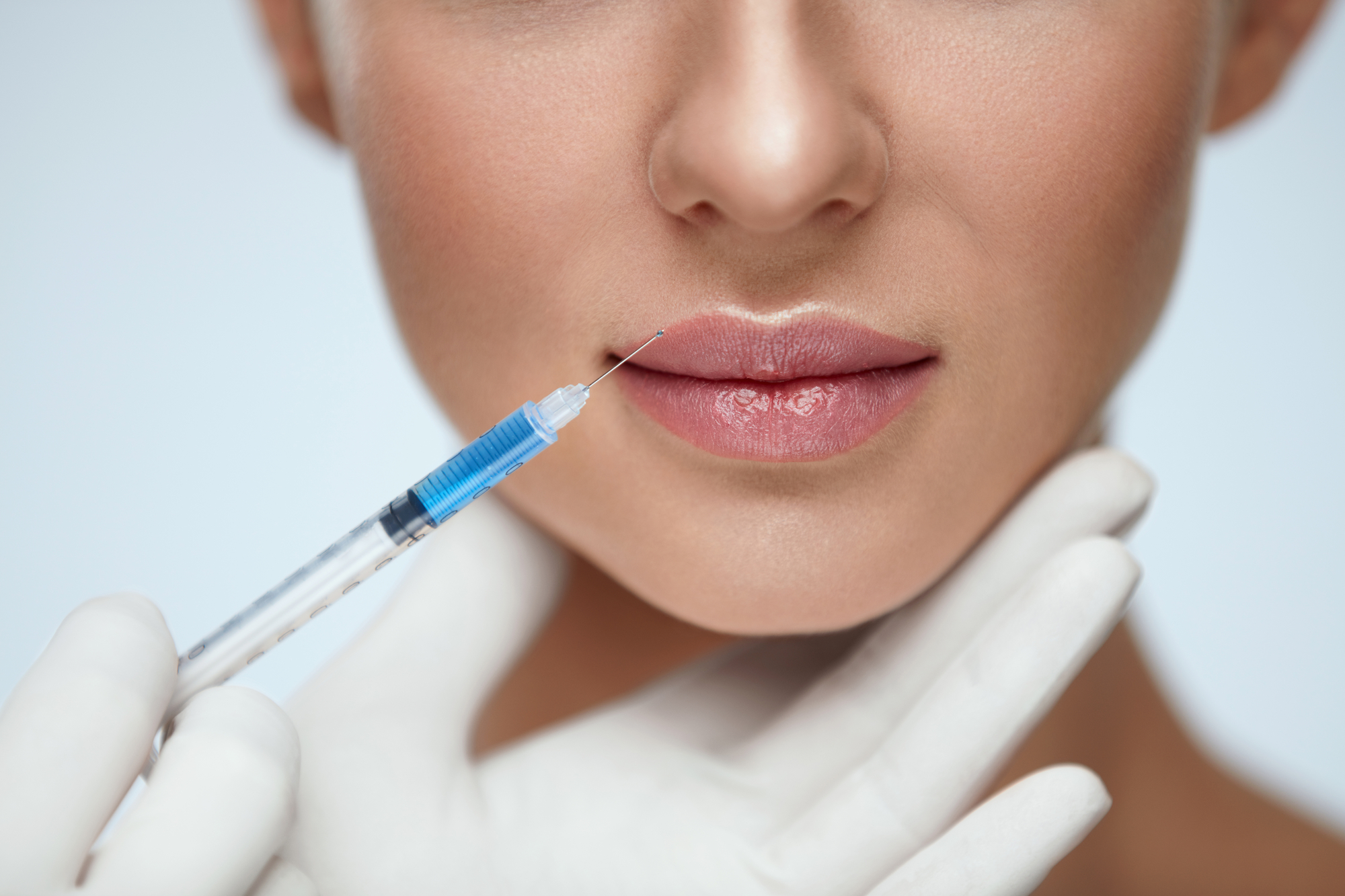 Dermal Filler Treatments at Renewed Skin and Wellness in Camas WA